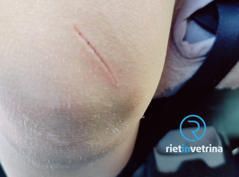 SEI TU IL REPORTER – “Mio figlio giocando in un parco di Rieti si è tagliato con una lattina sporca. Serve più attenzione dalle Istituzioni”