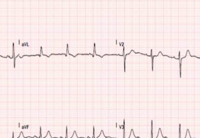 SEI TU IL REPORTER – “Da due mesi tento di prenotare ECG e visita cardiologica alla ASL Rieti, ma niente. Non possiamo andare sempre a pagamento”