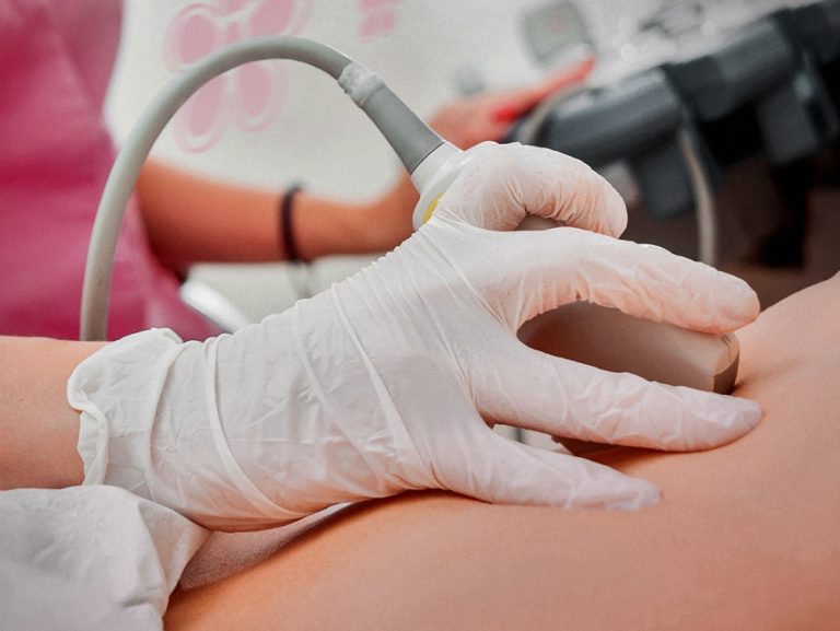 Endometriosi, raggiunta intesa sui nuovi livelli essenziali di assistenza